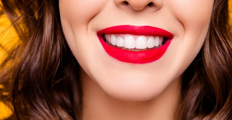 Straight teeth